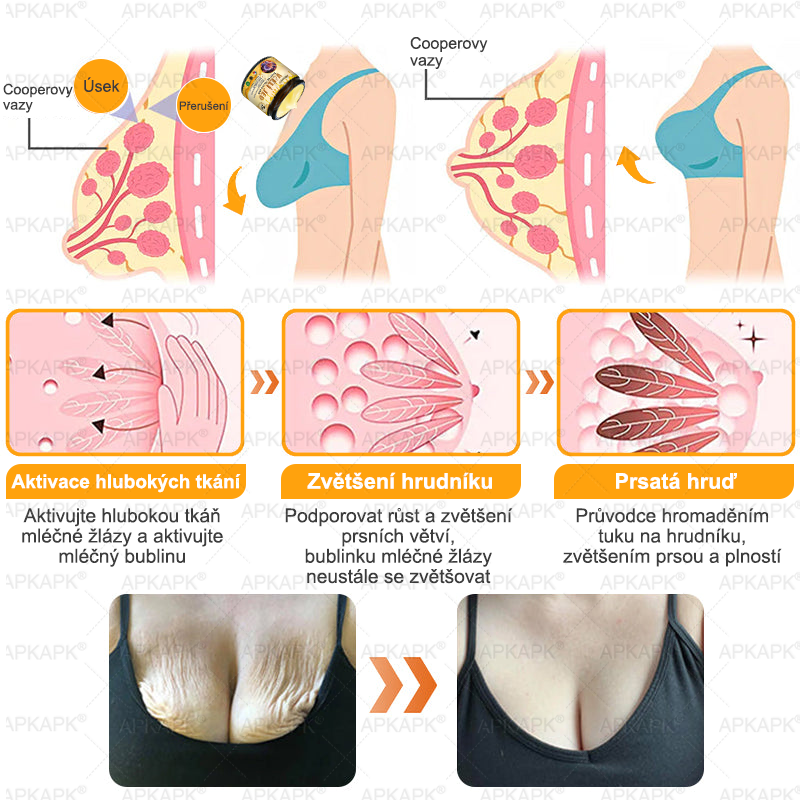 👩⚕️𝖠𝖯𝖪𝖠𝖯𝖪® Krém s včelím jedem na obnovu pokožky 🐝 pomáhá při řešení kožních problémů, jako jsou: vrásky, jizvy, pigmentové skvrny, strie, akné, lupénka, ekzém, kožní léze, podráždění, záněty a další kožní potíže.