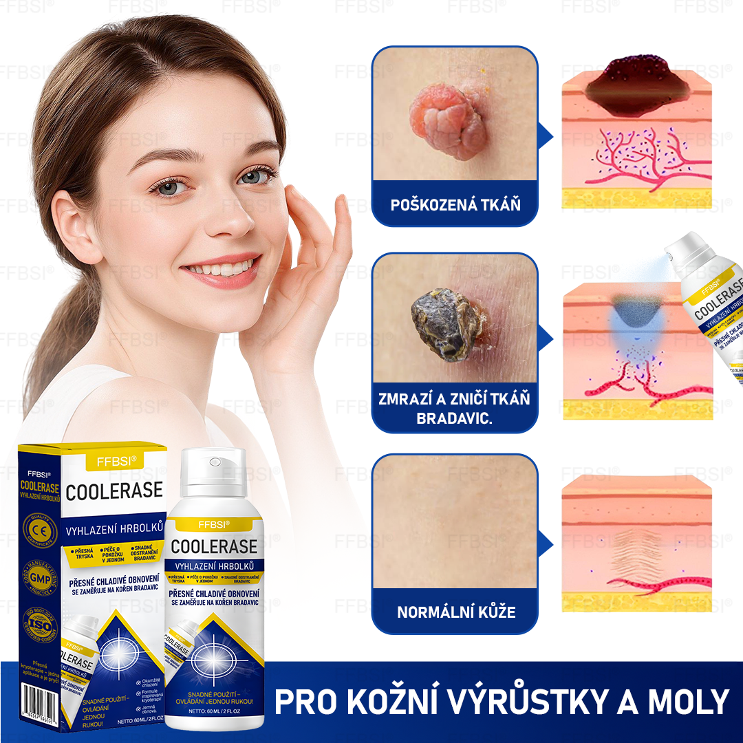 FFBSI® 💕 CoolErase Sprej pro regeneraci pokožky (Bradavice, Puchýře, Ekzém, Lupy, Kožní keratózy, Akné, Kožní výrůstky, Jizvy, Mateřská znaménka)