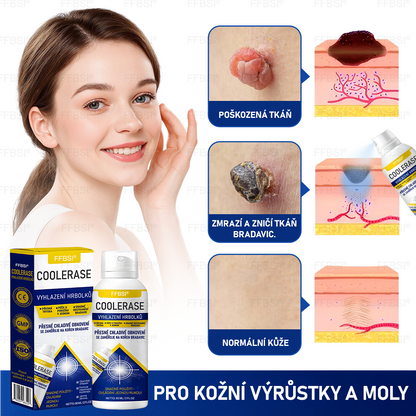 FFBSI® 💕 CoolErase Sprej pro regeneraci pokožky (Bradavice, Puchýře, Ekzém, Lupy, Kožní keratózy, Akné, Kožní výrůstky, Jizvy, Mateřská znaménka)