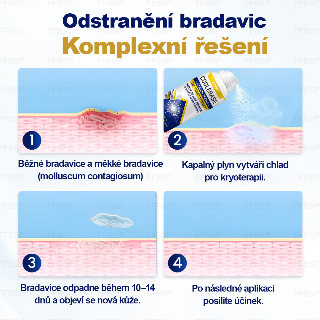 FFBSI® 💕 CoolErase Sprej pro regeneraci pokožky (Bradavice, Puchýře, Ekzém, Lupy, Kožní keratózy, Akné, Kožní výrůstky, Jizvy, Mateřská znaménka)
