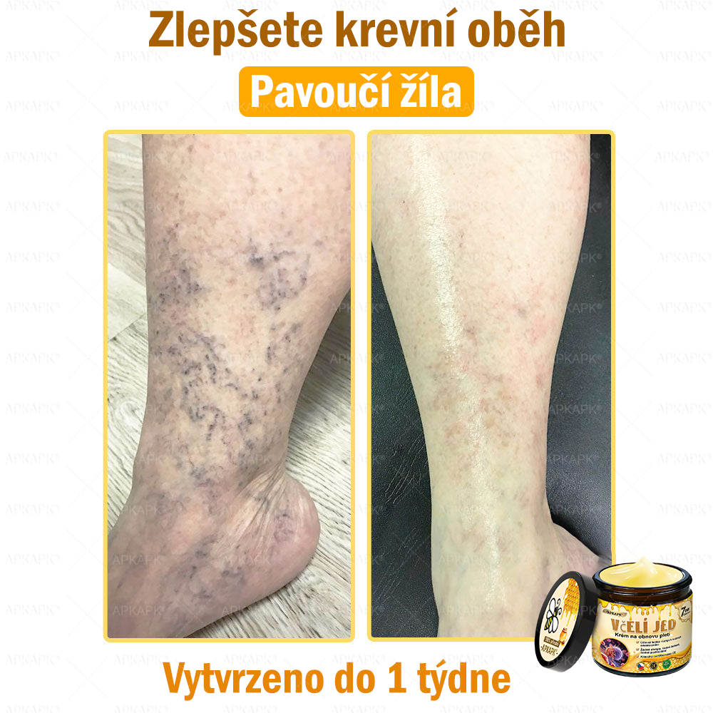 Dermatologicky a klinicky testováno👩‍⚕️APKAPK®Bee Venom Krém na obnovení pleti🐝 pomáhá při léčbě kožních problémů, jako jsou: vrásky, jizvy, pigmentové skvrny, strie, akné, psoriáza, ekzém, kožní změny, podráždění, záněty a další kožní problémy.