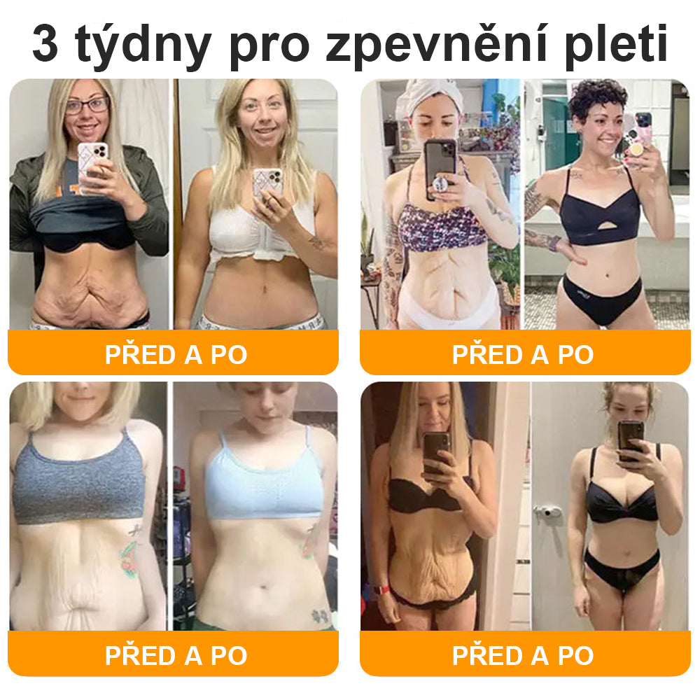 Poslední den akce: 50 % sleva - 🍯 HAJUEI® Botox Včelí jed Krém na odstranění vrásek