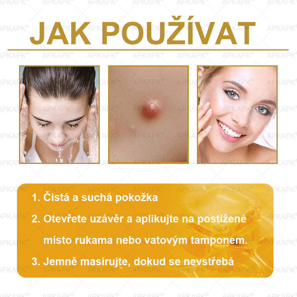 ✅𝖠𝖯𝖪𝖠𝖯𝖪® Krém s včelím jedem na obnovu pokožky 🐝 pomáhá při řešení kožních problémů, jako jsou: vrásky, jizvy, pigmentové skvrny, strie, akné, lupénka, ekzém, kožní léze, podráždění, záněty a další kožní potíže.