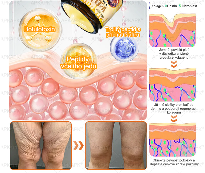 ✅𝖠𝖯𝖪𝖠𝖯𝖪® Krém s včelím jedem na obnovu pokožky 🐝 pomáhá při řešení kožních problémů, jako jsou: vrásky, jizvy, pigmentové skvrny, strie, akné, lupénka, ekzém, kožní léze, podráždění, záněty a další kožní potíže.