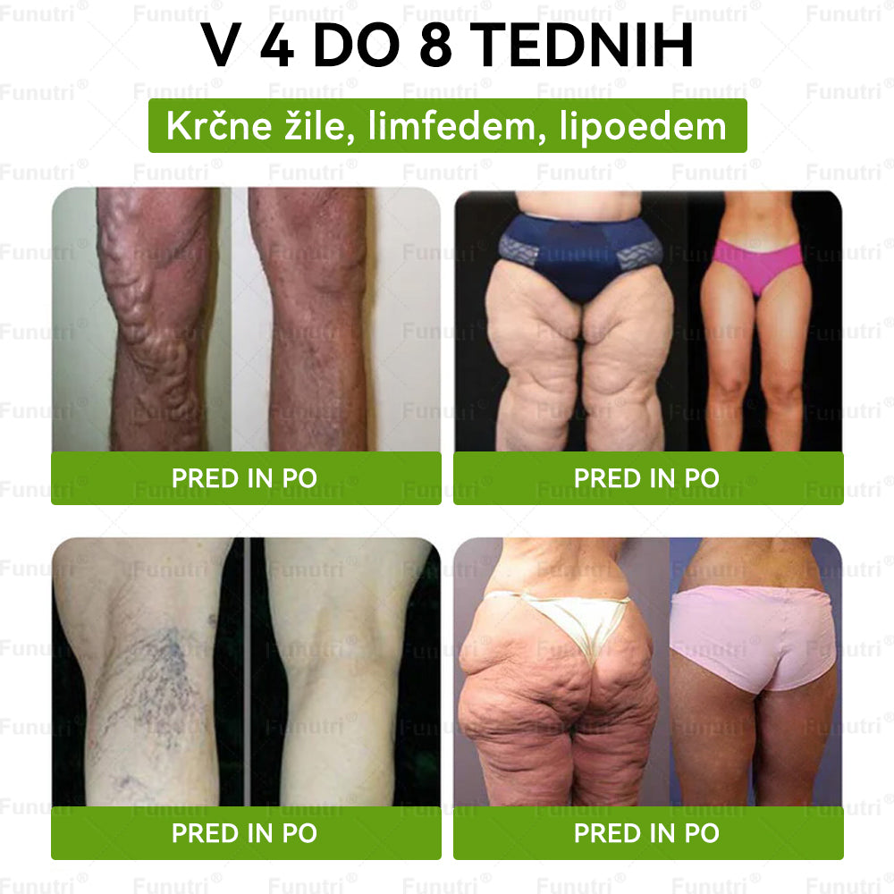 Rekomenduoja Lietuvos specialistai 💖 Funutri® 10-in-1 nano mikroadatinis pleistras medžiagų apykaitai ir kūno svorio reguliavimui palaikyti