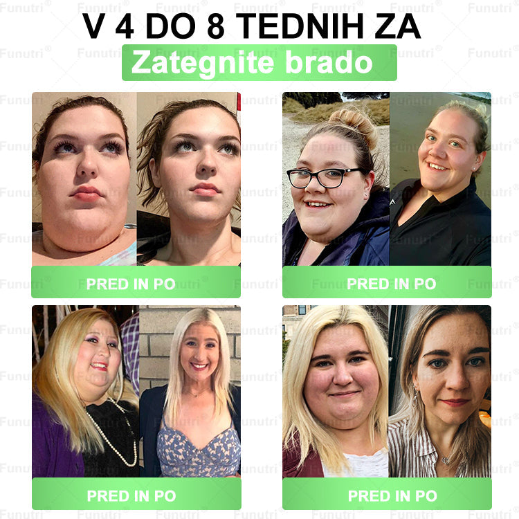 Rekomenduoja Lietuvos specialistai 💖 Funutri® 10-in-1 nano mikroadatinis pleistras medžiagų apykaitai ir kūno svorio reguliavimui palaikyti