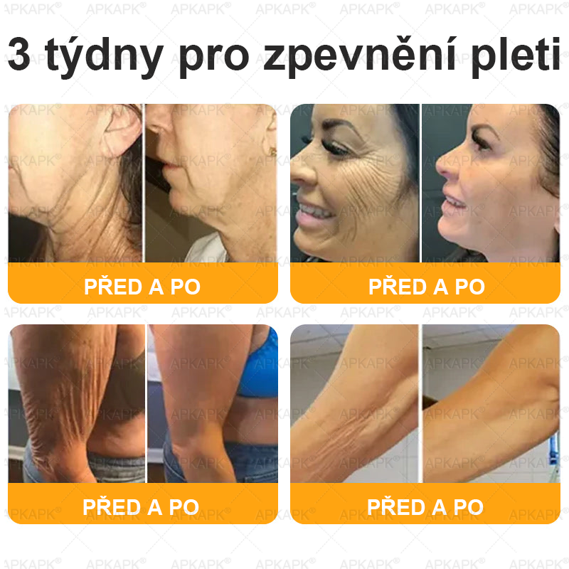 ✅𝖠𝖯𝖪𝖠𝖯𝖪® Krém s včelím jedem na obnovu pokožky 🐝 pomáhá při řešení kožních problémů, jako jsou: vrásky, jizvy, pigmentové skvrny, strie, akné, lupénka, ekzém, kožní léze, podráždění, záněty a další kožní potíže.
