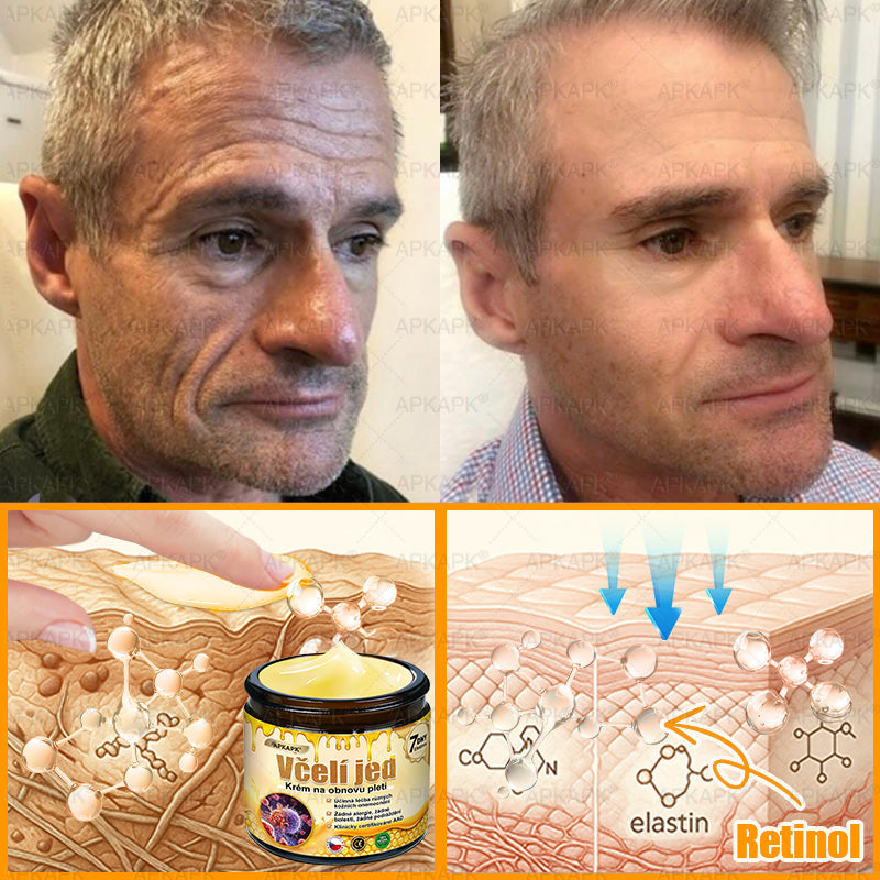 ✅𝖠𝖯𝖪𝖠𝖯𝖪® Krém s včelím jedem na obnovu pokožky 🐝 pomáhá při řešení kožních problémů, jako jsou: vrásky, jizvy, pigmentové skvrny, strie, akné, lupénka, ekzém, kožní léze, podráždění, záněty a další kožní potíže.