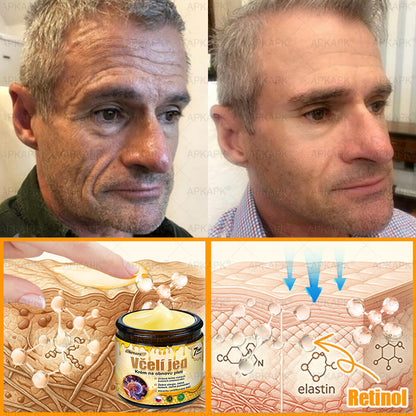 ✅𝖠𝖯𝖪𝖠𝖯𝖪® Krém s včelím jedem na obnovu pokožky 🐝 pomáhá při řešení kožních problémů, jako jsou: vrásky, jizvy, pigmentové skvrny, strie, akné, lupénka, ekzém, kožní léze, podráždění, záněty a další kožní potíže.