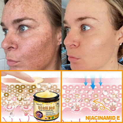 ✅𝖠𝖯𝖪𝖠𝖯𝖪® Krém s včelím jedem na obnovu pokožky 🐝 pomáhá při řešení kožních problémů, jako jsou: vrásky, jizvy, pigmentové skvrny, strie, akné, lupénka, ekzém, kožní léze, podráždění, záněty a další kožní potíže.