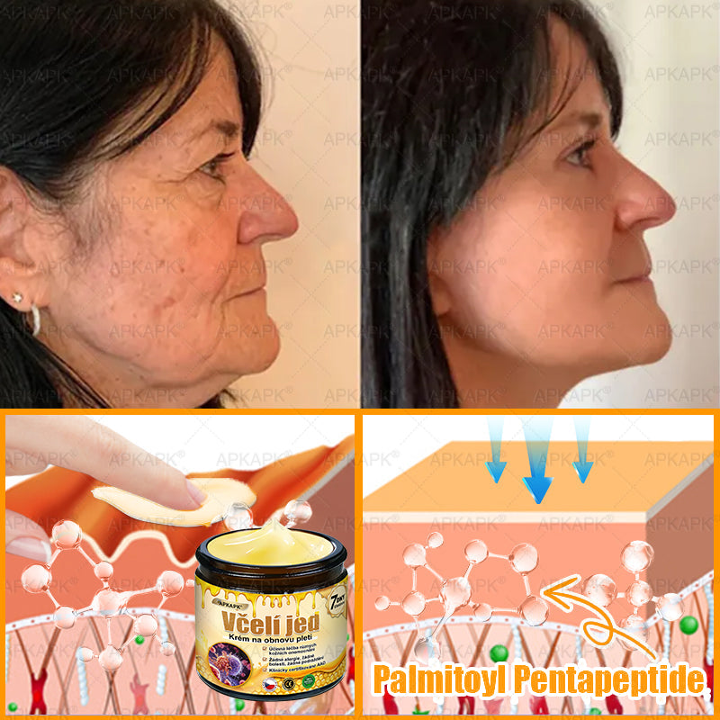 ✅𝖠𝖯𝖪𝖠𝖯𝖪® Krém s včelím jedem na obnovu pokožky 🐝 pomáhá při řešení kožních problémů, jako jsou: vrásky, jizvy, pigmentové skvrny, strie, akné, lupénka, ekzém, kožní léze, podráždění, záněty a další kožní potíže.