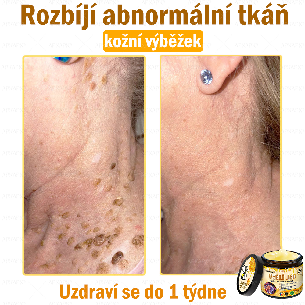 Dermatologicky a klinicky testováno👩‍⚕️APKAPK®Bee Venom Krém na obnovení pleti🐝 pomáhá při léčbě kožních problémů, jako jsou: vrásky, jizvy, pigmentové skvrny, strie, akné, psoriáza, ekzém, kožní změny, podráždění, záněty a další kožní problémy.