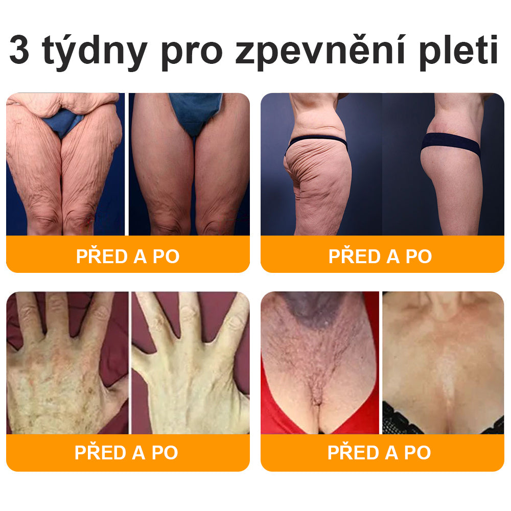Poslední den akce: 50 % sleva - 🍯 HAJUEI® Botox Včelí jed Krém na odstranění vrásek