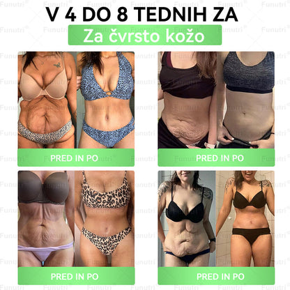 Rekomenduoja Lietuvos specialistai 💖 Funutri® 10-in-1 nano mikroadatinis pleistras medžiagų apykaitai ir kūno svorio reguliavimui palaikyti